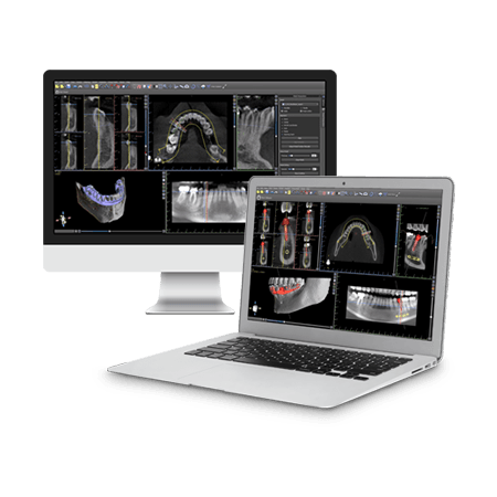 Case Planning Thumbnail